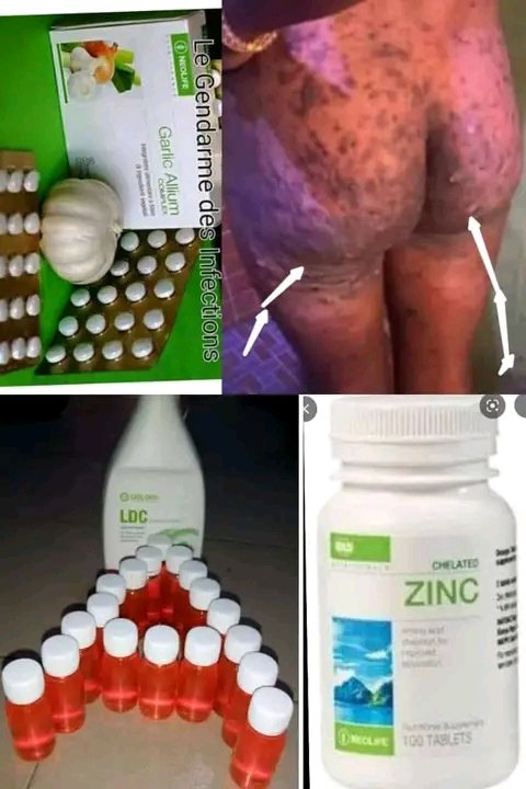 La santé Bio nutritionnelles