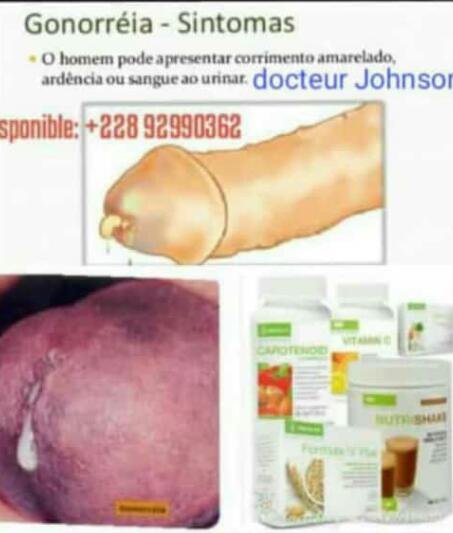 La santé Bio nutritionnelles