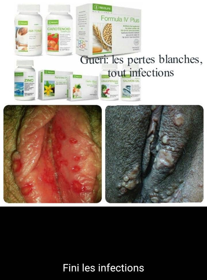 La santé Bio nutritionnelles